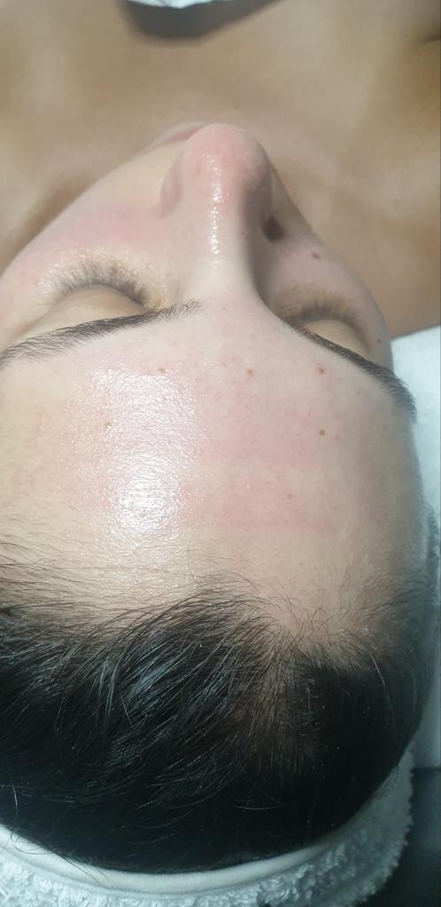 קרן קוסמטיקה קרן קוסמטיקה