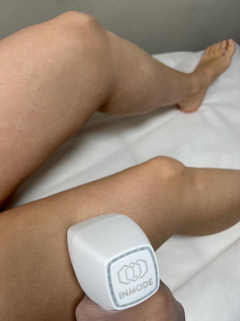 הממלכה ליופי הממלכה ליופי