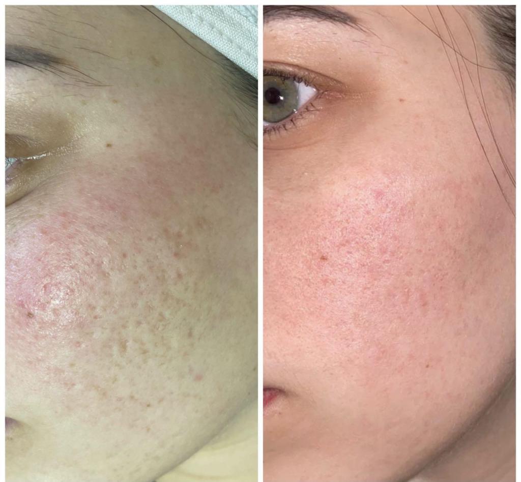 Meshi skin Meshi skin