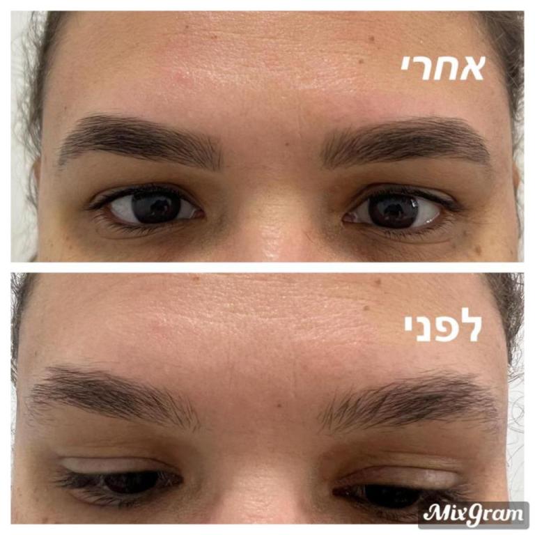 Hodaya Biton Hodaya Biton