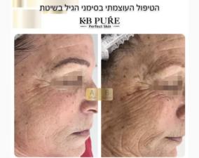 Benlichi cosmetics