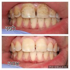 נטלי שאואט