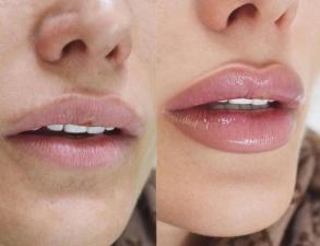 ענבר עמר SheinBeauty