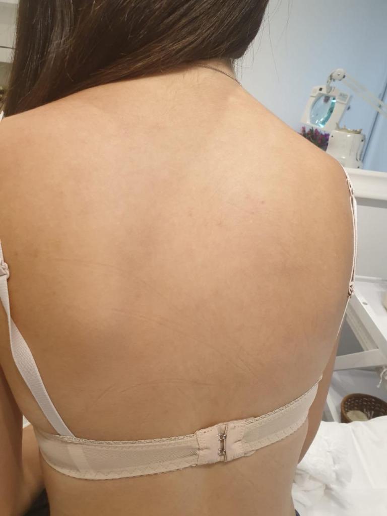 סנטר לייזר סנטר לייזר