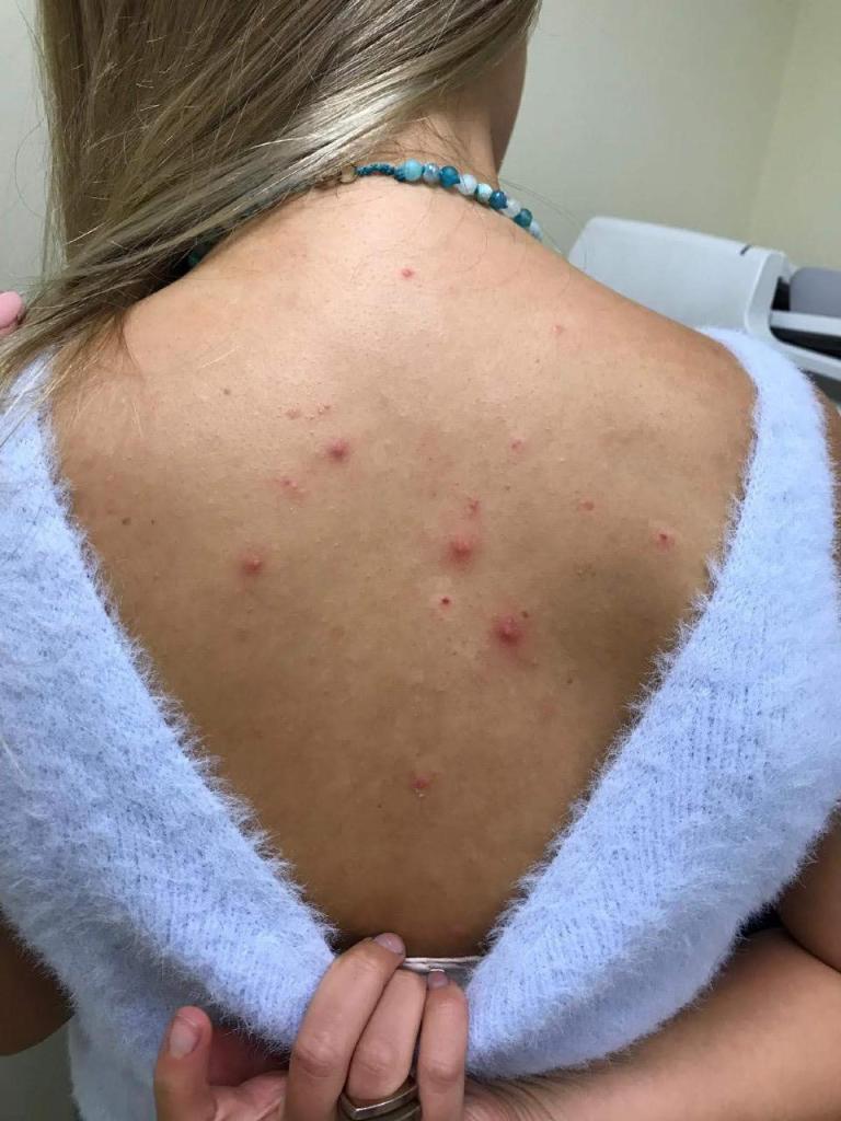 סנטר לייזר סנטר לייזר