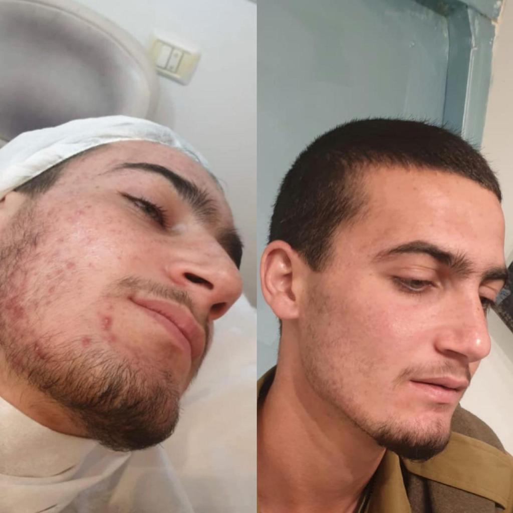 סנטר לייזר סנטר לייזר