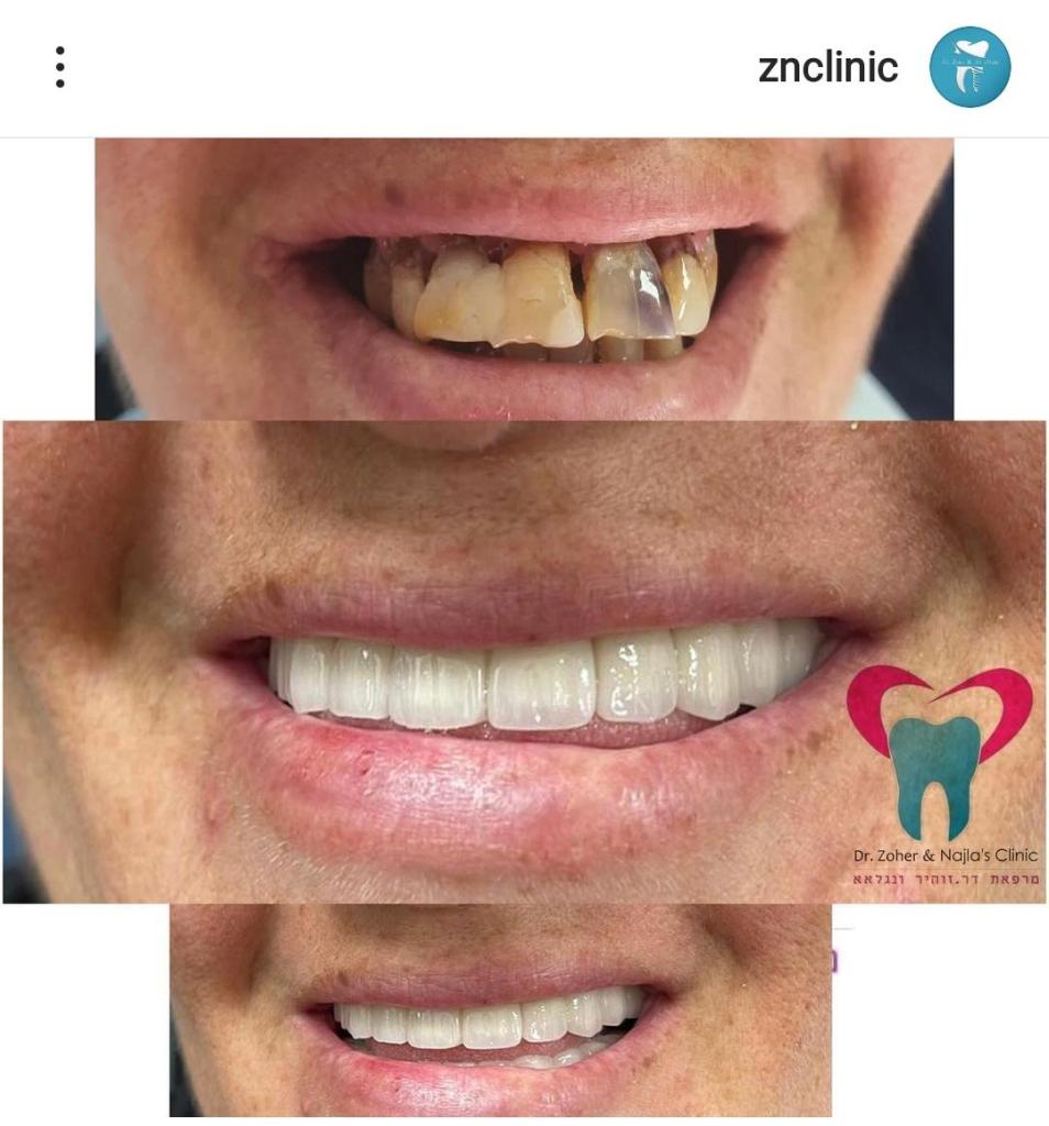 זוהיר ונגלאא זוהיר ונגלאא