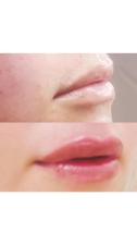 H BEAUTY