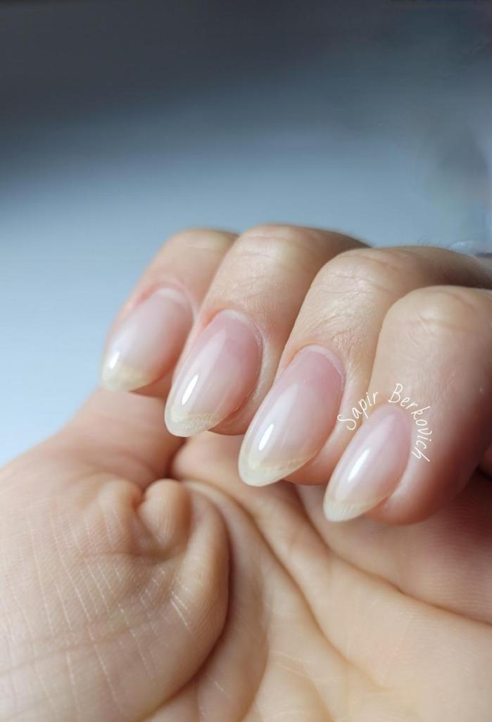 ספיר ברקוביץ ספיר ברקוביץ