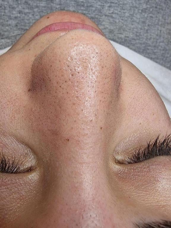 נטלי לוין נטלי לוין