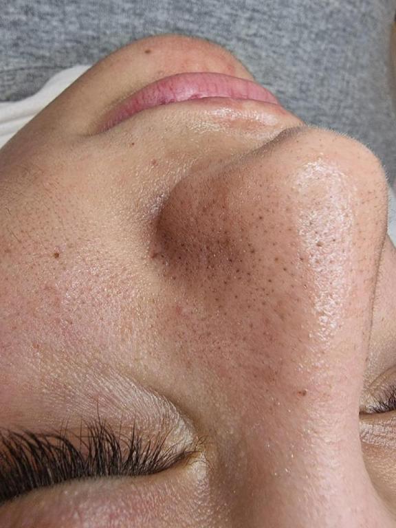 נטלי לוין נטלי לוין