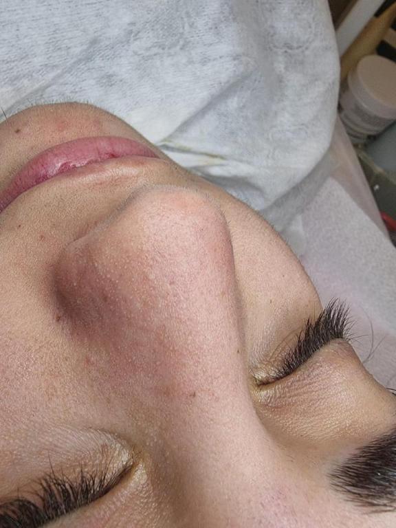 נטלי לוין נטלי לוין