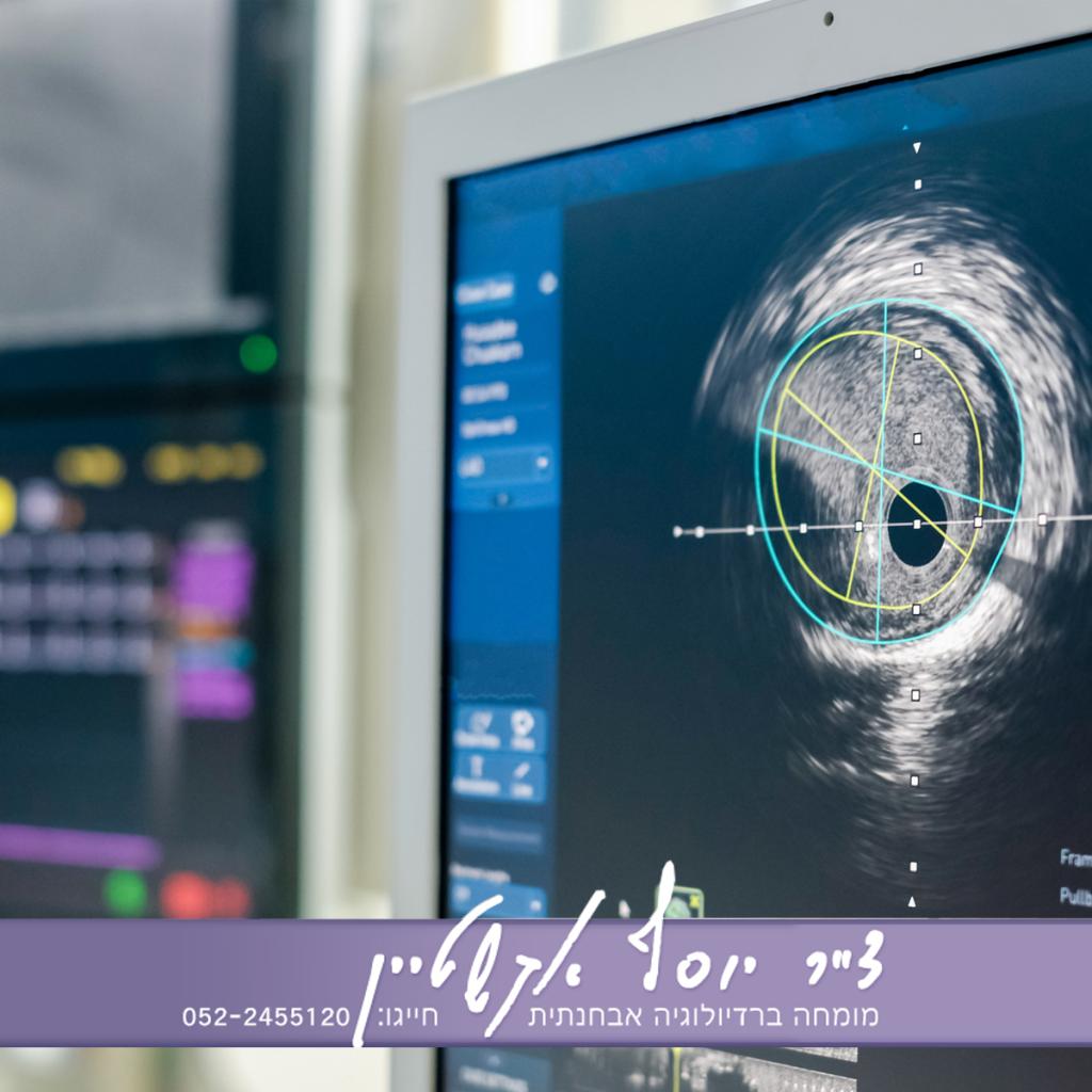 ד"ר אקשטיין יוסף ד"ר אקשטיין יוסף