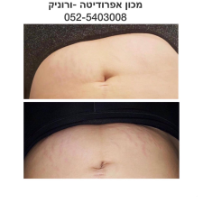 אפרודיטה מכון קוסמטיקה  מנוהל