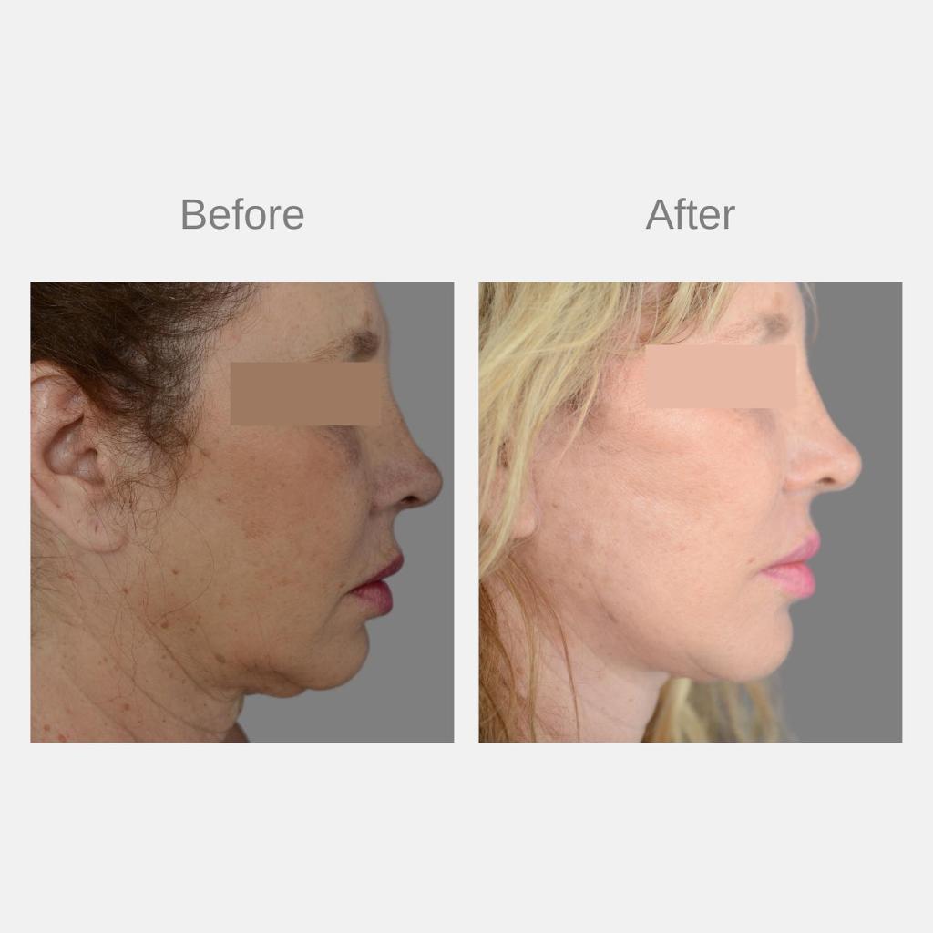 פרופ' וינקלר אייל פרופ' וינקלר אייל