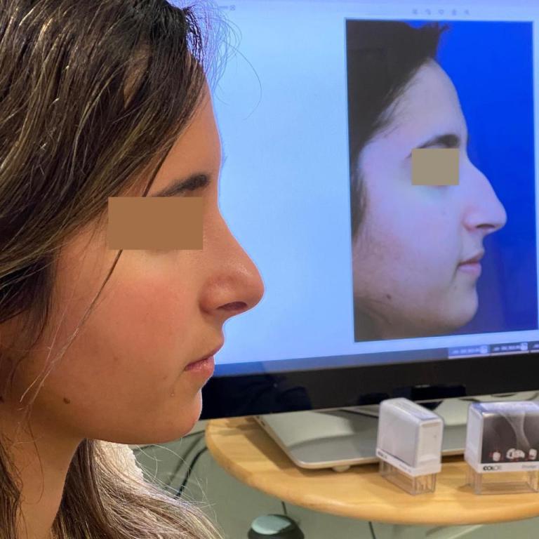 פרופ' וינקלר אייל פרופ' וינקלר אייל