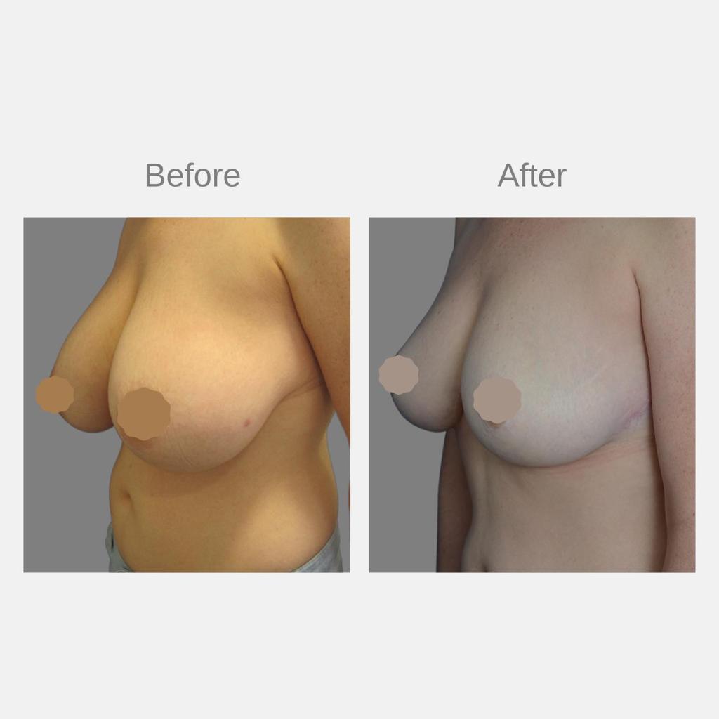 פרופ' וינקלר אייל פרופ' וינקלר אייל