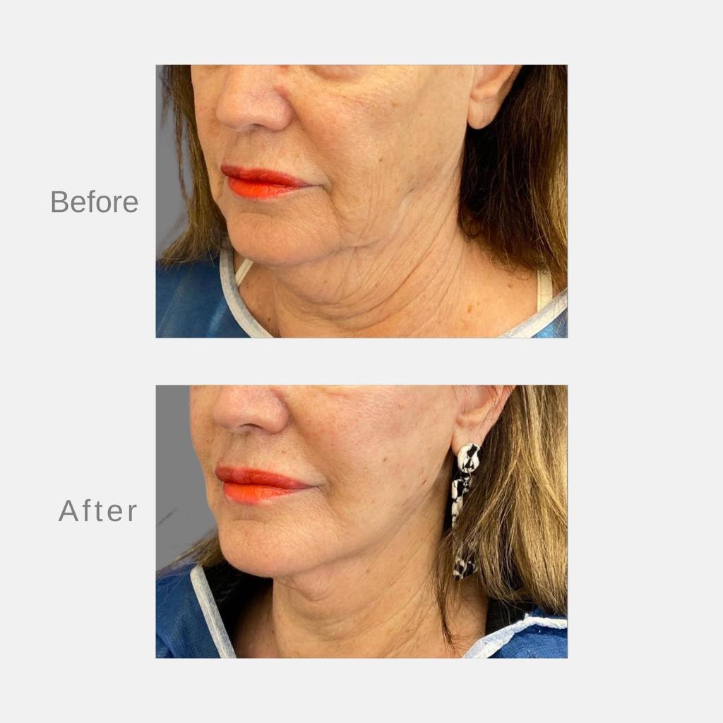 פרופ' וינקלר אייל פרופ' וינקלר אייל