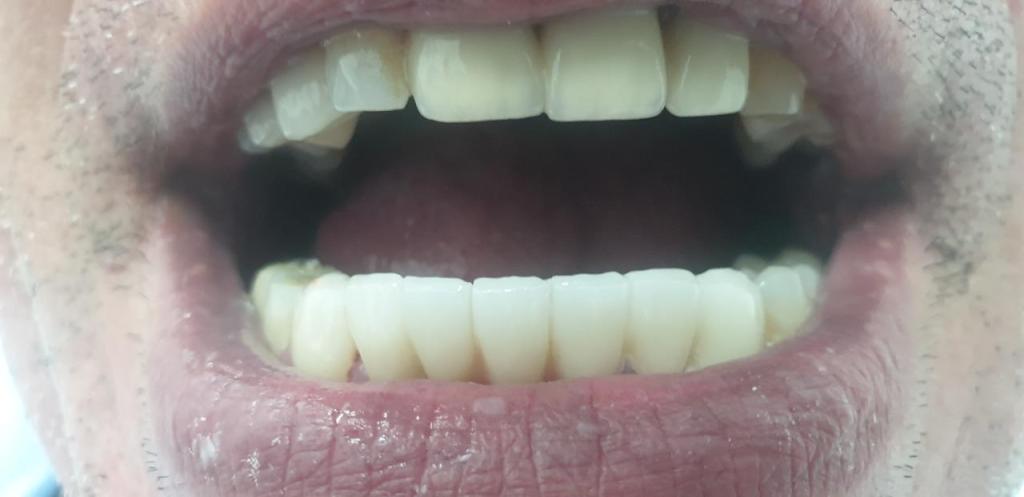 בי אסתטיק בי אסתטיק