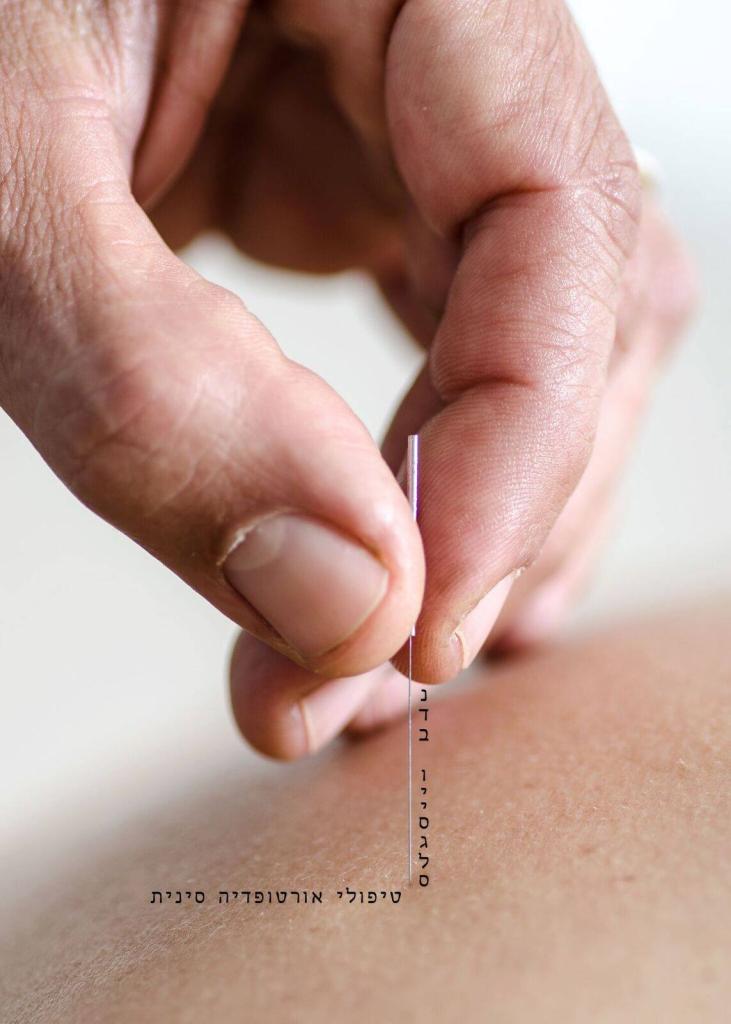 נדב וייסגלס טיפולי אורטופדיה סינית נדב וייסגלס טיפולי אורטופדיה סינית