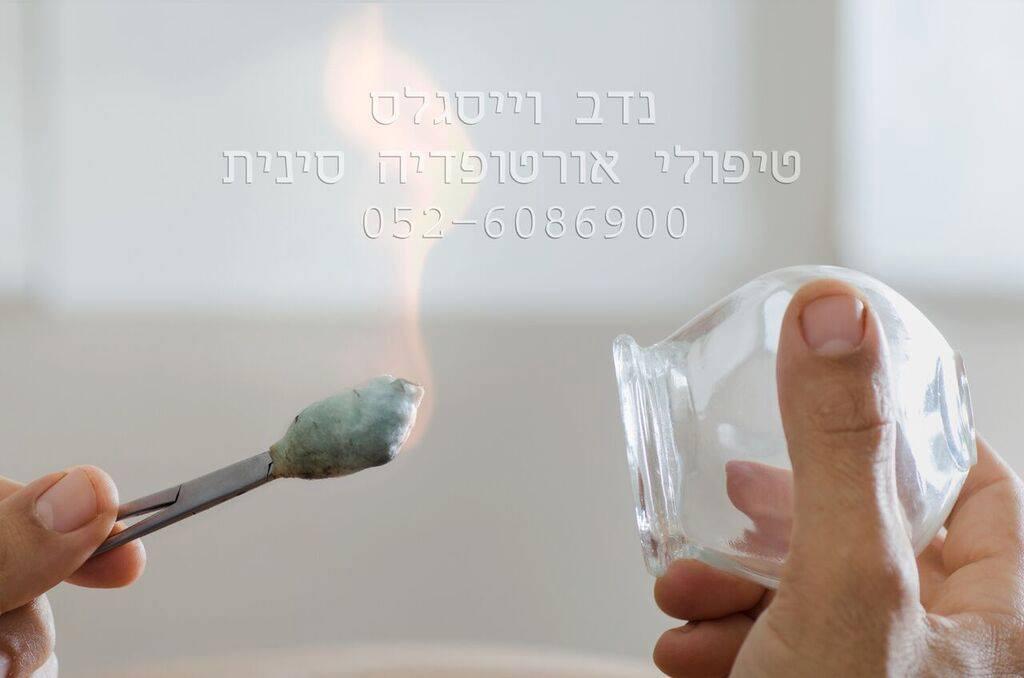 נדב וייסגלס טיפולי אורטופדיה סינית נדב וייסגלס טיפולי אורטופדיה סינית