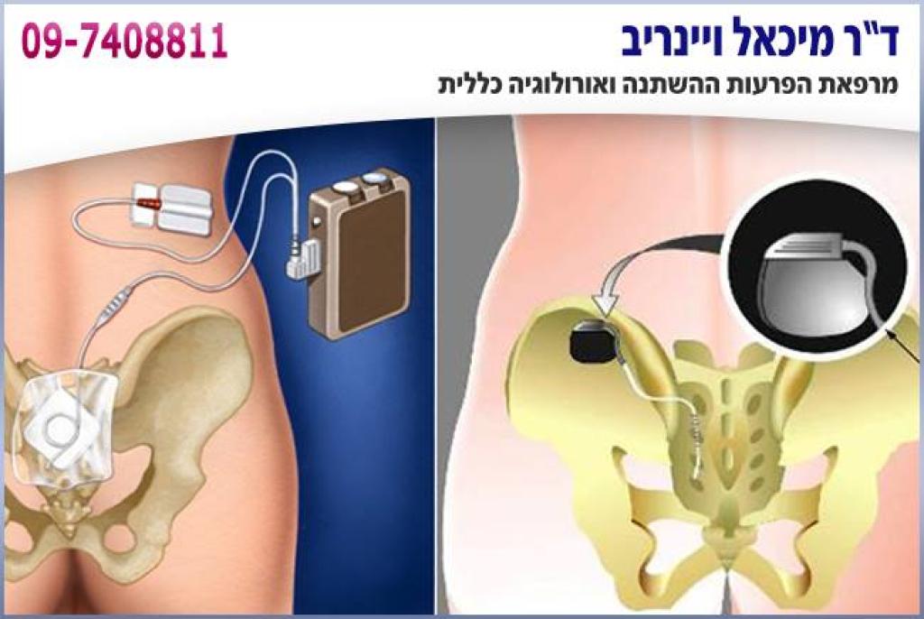 ד"ר ויינריב מיכאל ד"ר ויינריב מיכאל