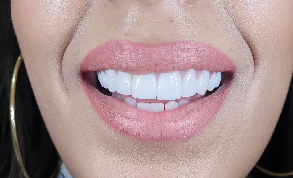 המרכז להשתלות שיניים ואסתטיקה המרכז להשתלות שיניים ואסתטיקה