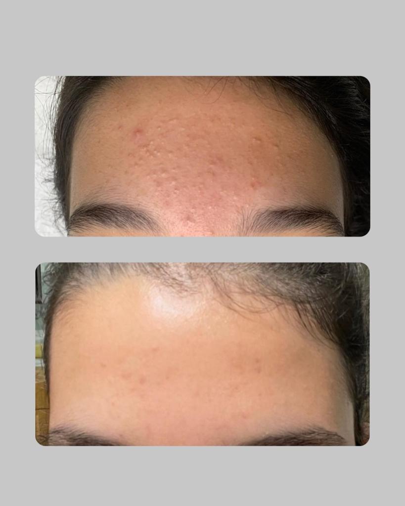 ברודסקי וקנין פולינה ברודסקי וקנין פולינה