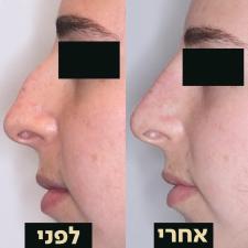 ד"ר אופיר ארצי מרכז מומחים