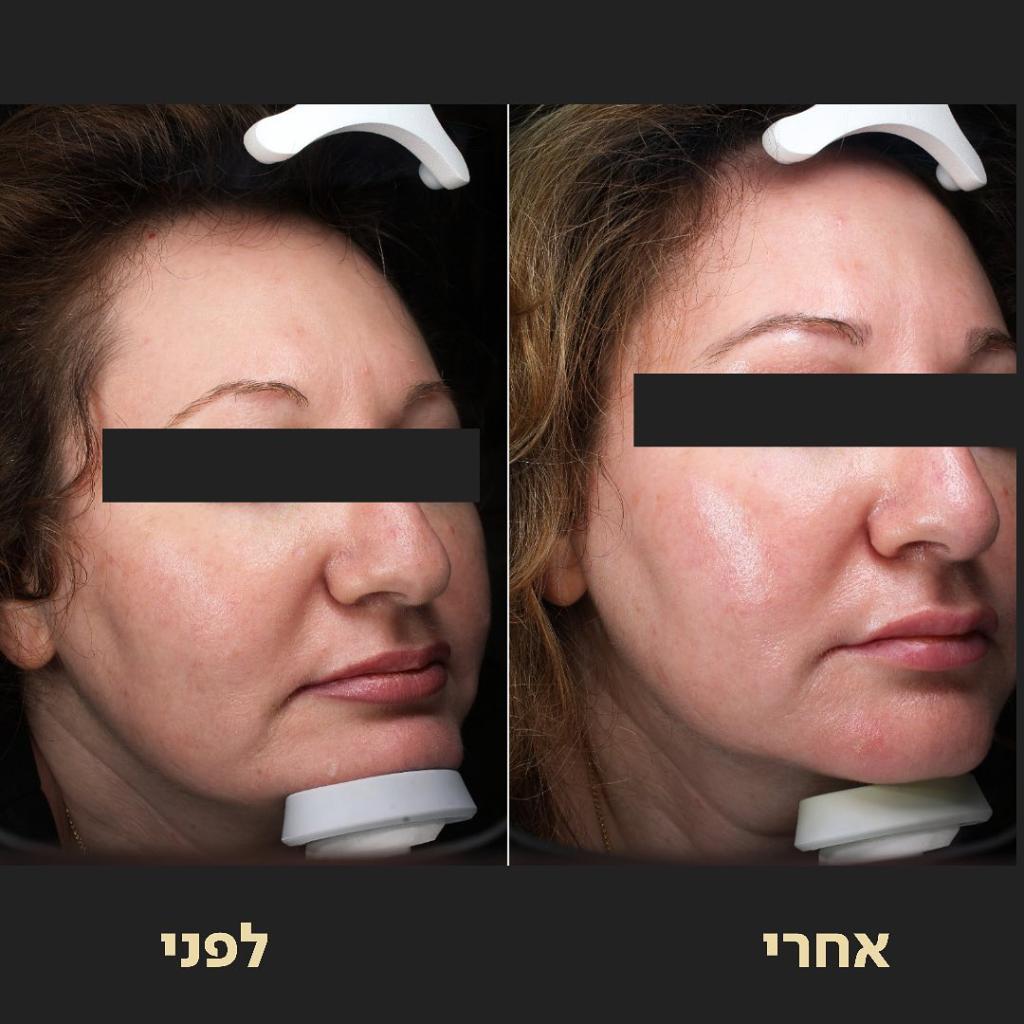 ד"ר אופיר ארצי מרכז מומחים ד"ר אופיר ארצי מרכז מומחים