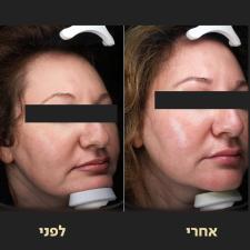 ד"ר אופיר ארצי מרכז מומחים