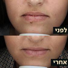 ד"ר אופיר ארצי מרכז מומחים