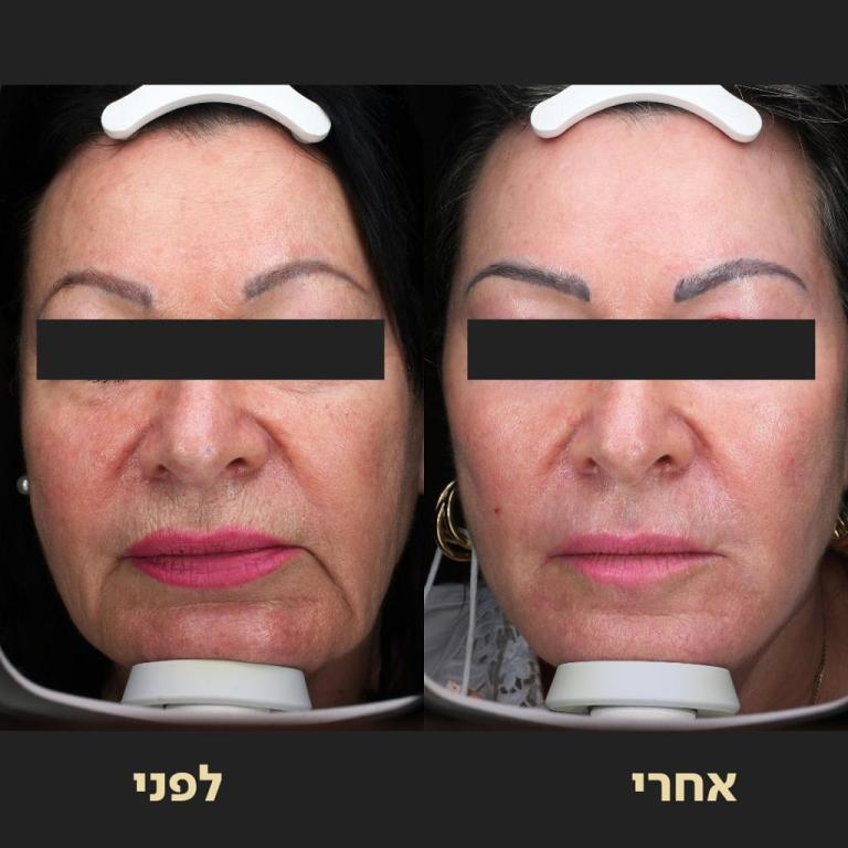 ד"ר אופיר ארצי מרכז מומחים ד"ר אופיר ארצי מרכז מומחים