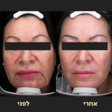 ד"ר אופיר ארצי מרכז מומחים
