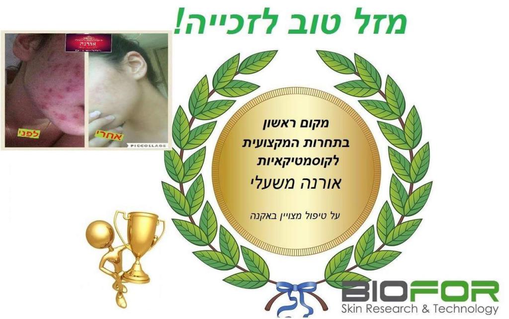 אורנה אורנה