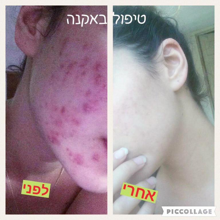 אורנה אורנה