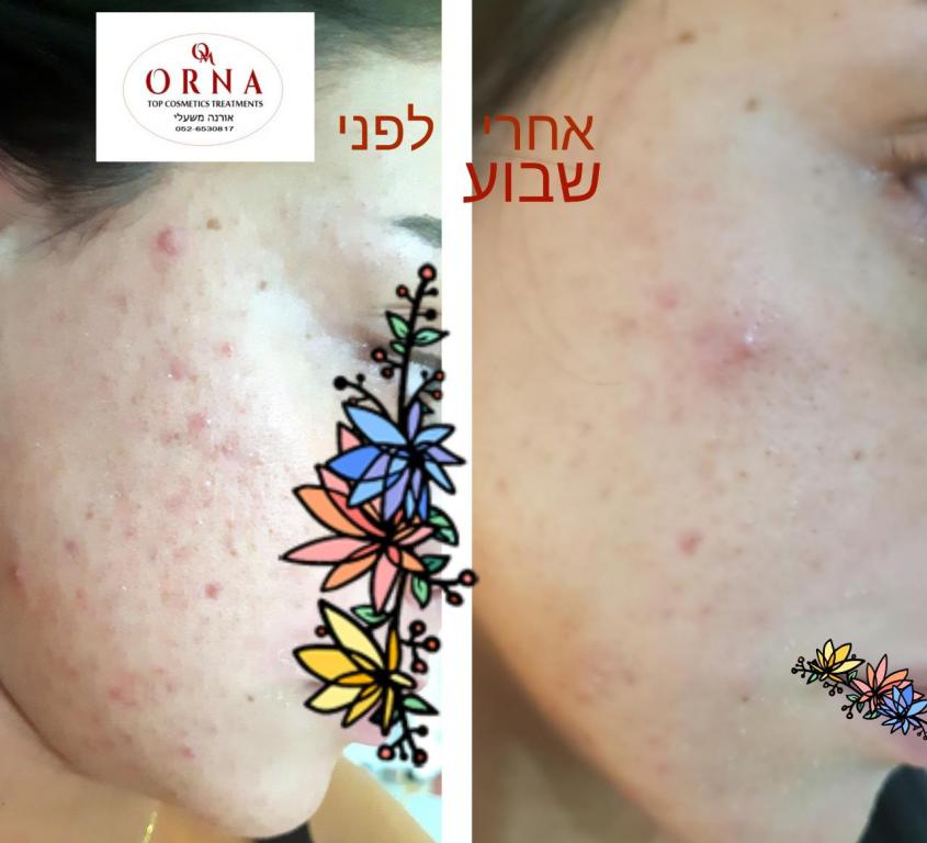 אורנה אורנה