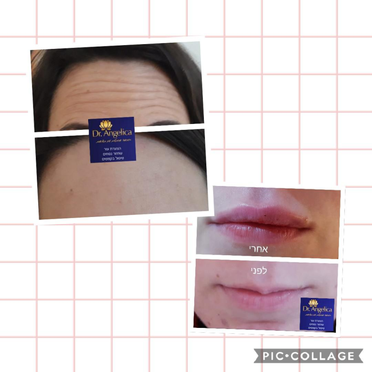 אורנה אורנה