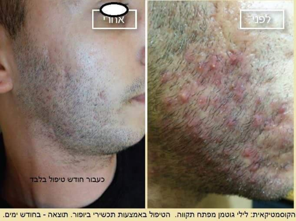 לילי גוטמן קוסמטיקאית לילי גוטמן קוסמטיקאית