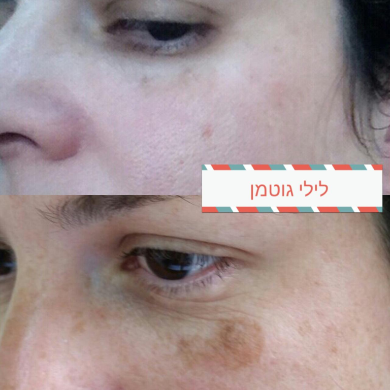 לילי גוטמן קוסמטיקאית לילי גוטמן קוסמטיקאית