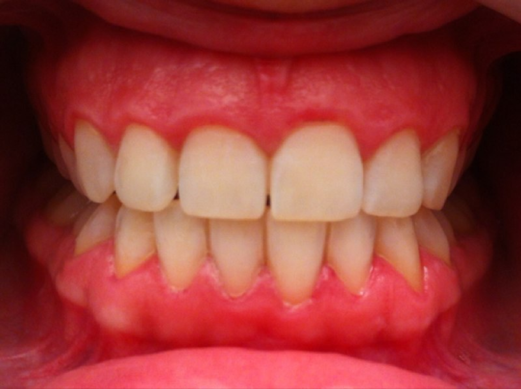 ד"ר גנדלמן גנדי ד"ר גנדלמן גנדי