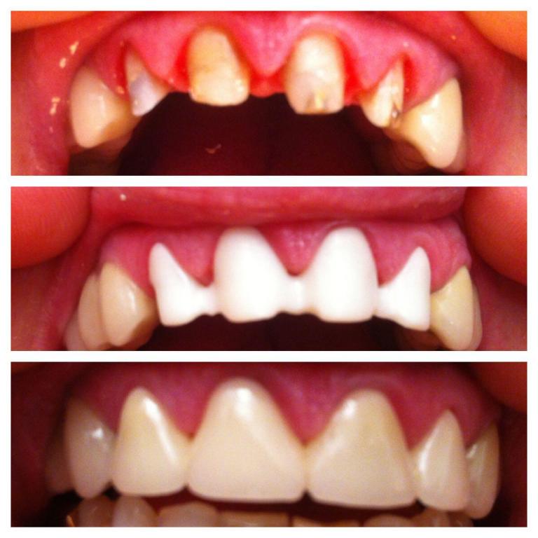 ד"ר גנדלמן גנדי ד"ר גנדלמן גנדי