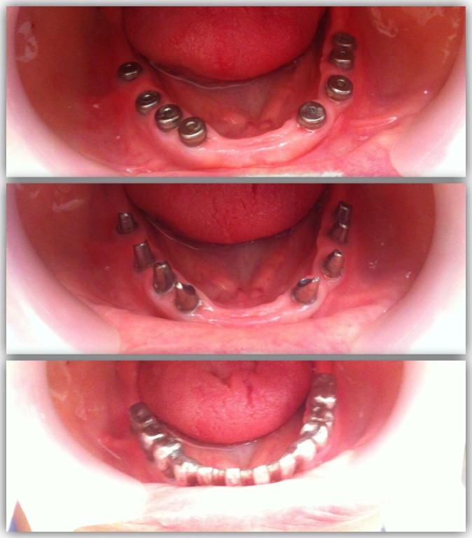 ד"ר גנדלמן גנדי ד"ר גנדלמן גנדי