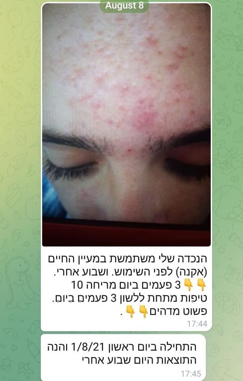 מור קליניק מור קליניק