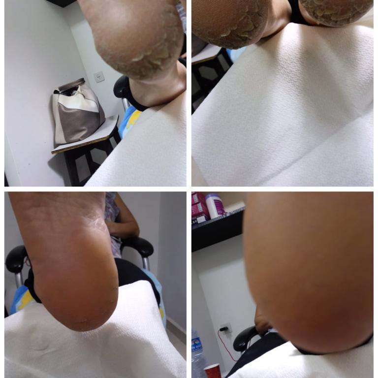 בניית ציפורניים רחל בניית ציפורניים רחל