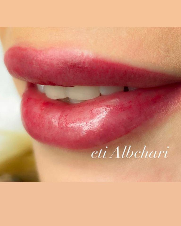 אלבכרי אתי אלבכרי אתי