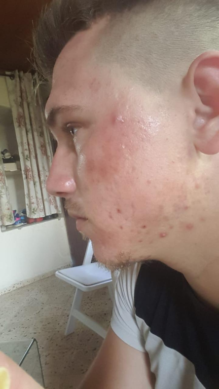 גלוריה המרכז לטיפולים קוסמטיים גלוריה המרכז לטיפולים קוסמטיים