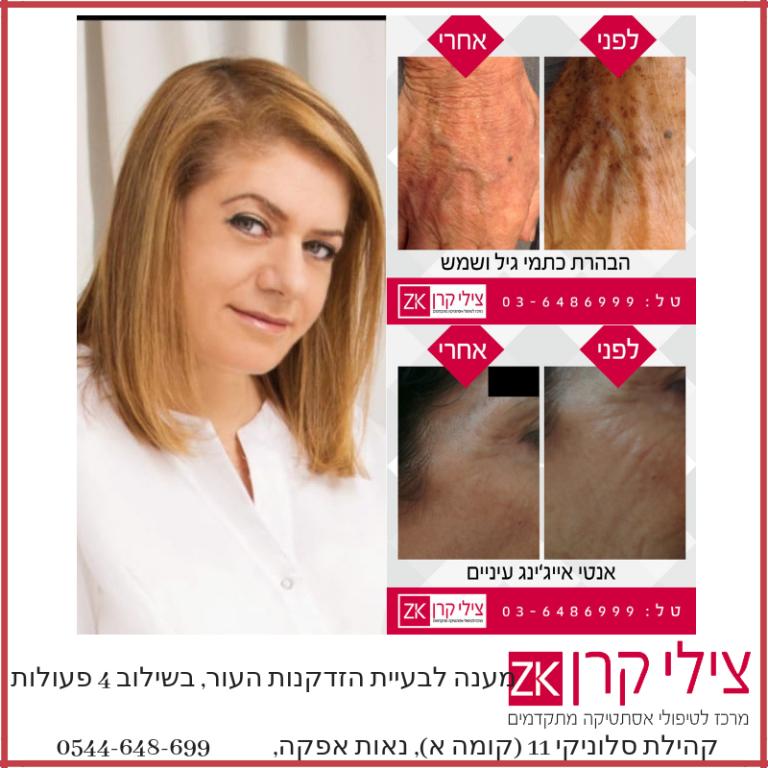 צילי קרן דרמאור קליניק צילי קרן דרמאור קליניק