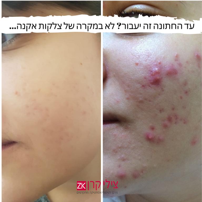צילי קרן דרמאור קליניק צילי קרן דרמאור קליניק