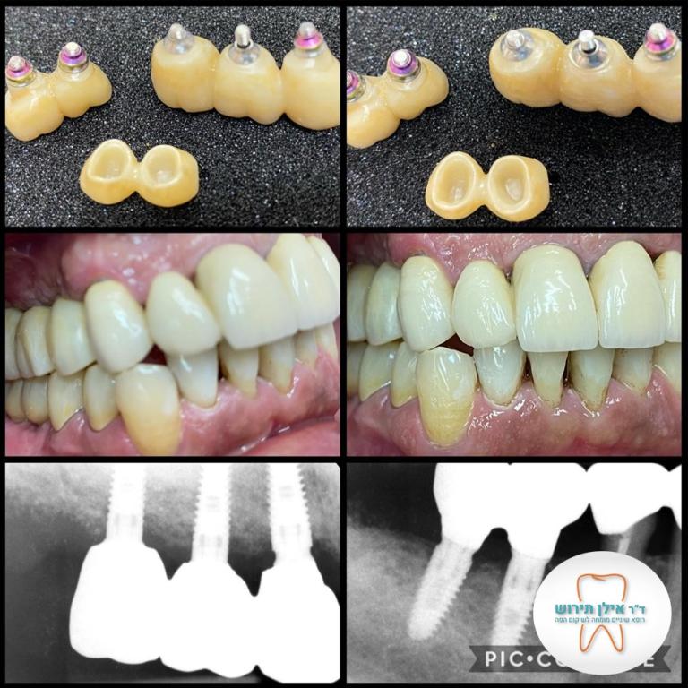 ד"ר תירוש אילן ד"ר תירוש אילן